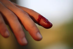 bleeding-finger-closeup-view-index-right-human-hand-cut-hurt-bright-red-blood-outdoor-sunny-day-blured-60484114